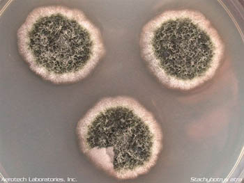 What Toxic Black Mold In A Petri Dish Home Mold Test Kit Looks Like? for Black Mold In Petri Dish